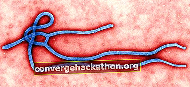 Ébola;  ebolavirus